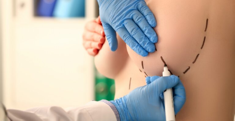 breast reduction antalya
