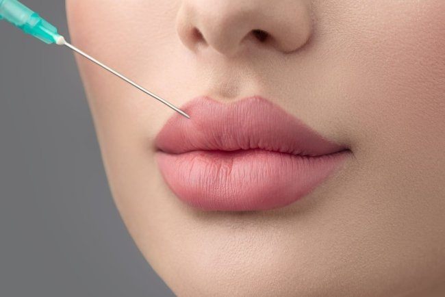 The Best Plastic Surgeon in Dubai: Mastering the Art of Russian Lip Fillers for Natural Results