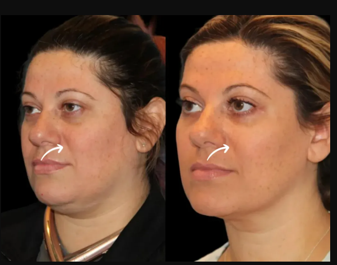 Best Aesthetic Clinics in dubai