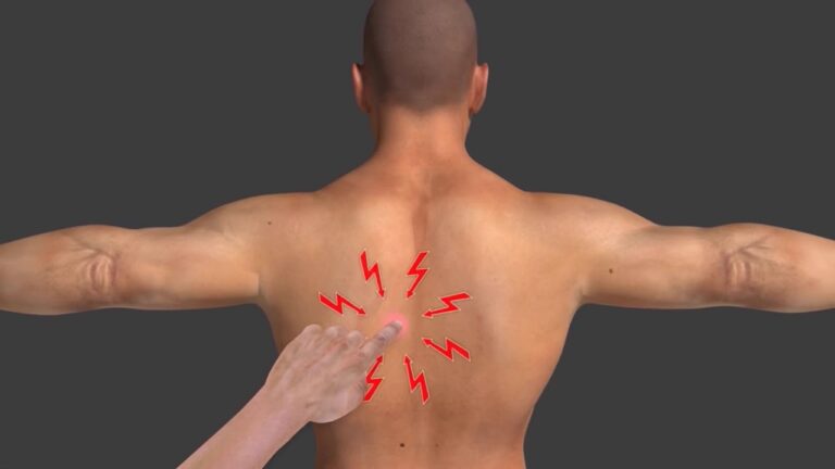 Trigger Point Injections