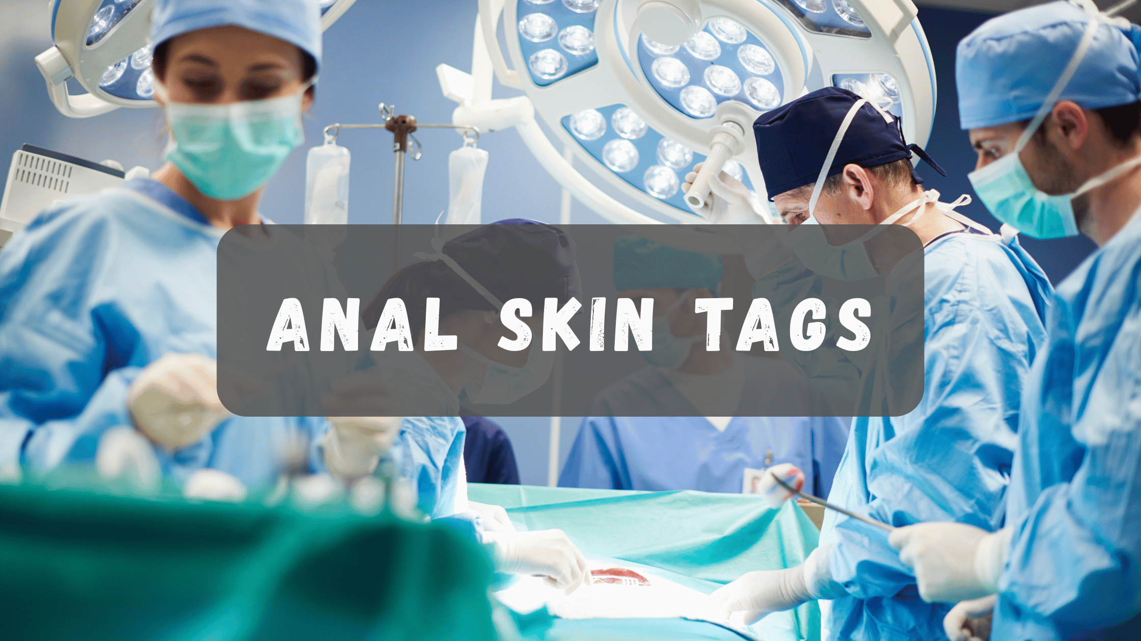 anal skin tags