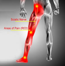 leg pain
