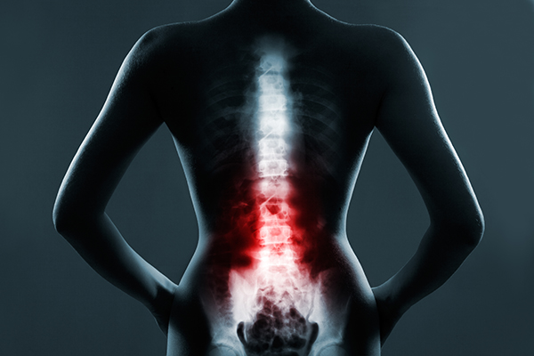 Endoscopic Spine Surgery- The Best Less Invasive Spine Surgery