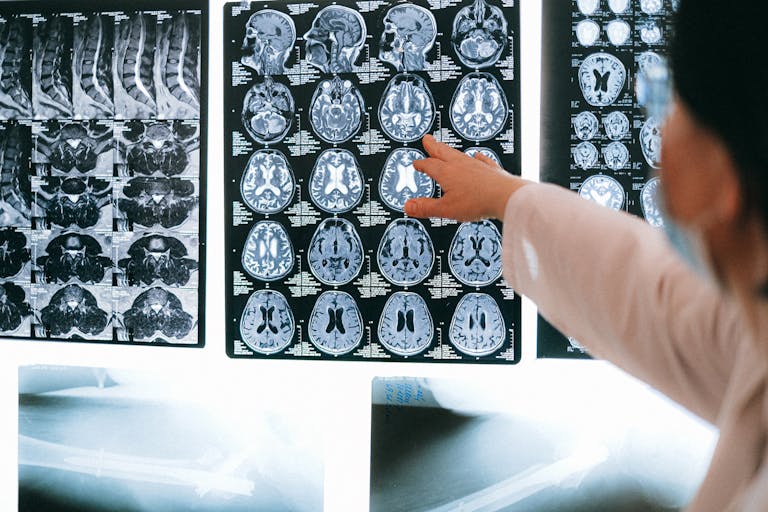 MRI Expert Witness in Medical Malpractice Cases