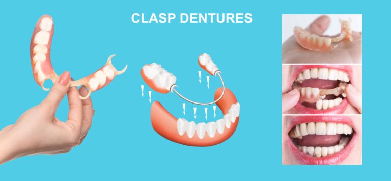 Teeth Whitening