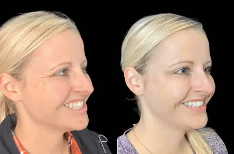 The Best Doctors in dubai Recommend These Pre-Botox Skincare Tips