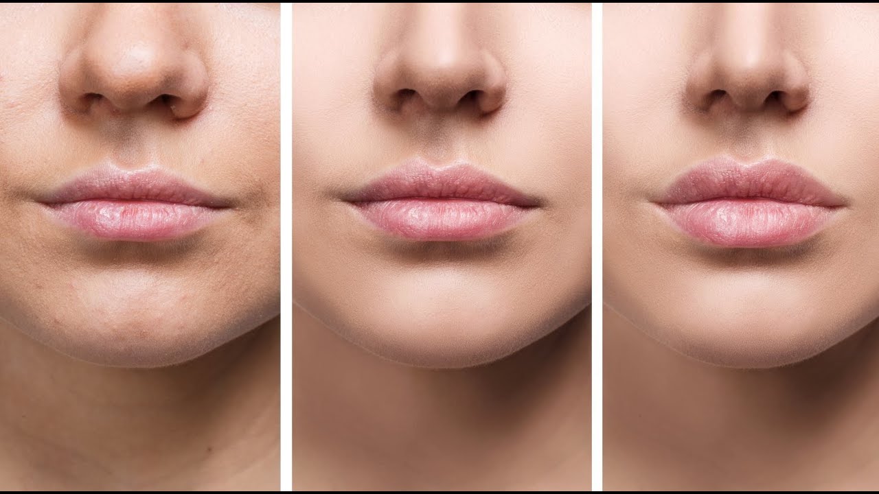 Affordable Lip Flip Treatments in Novi: Where to Go