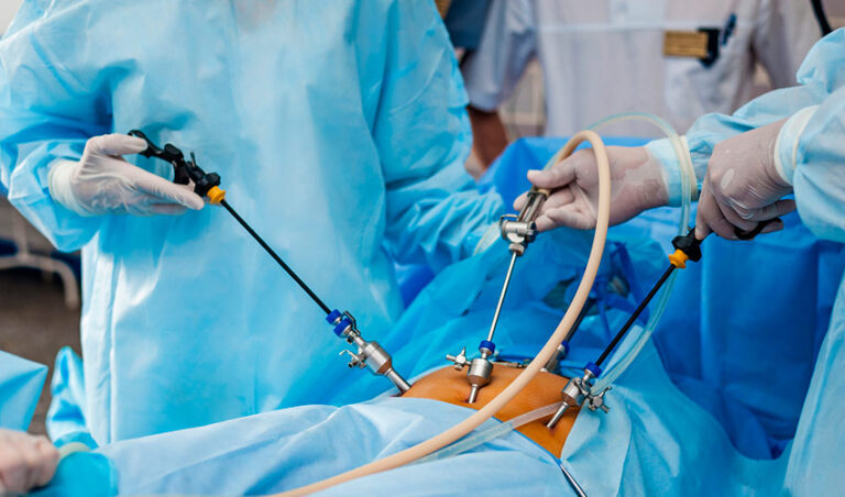 Is Laparoscopic Gallbladder Surgery Safe